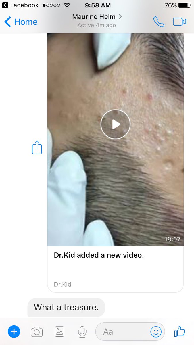calldoll_9's tweet photo. My grandma loves those pimple popping videos so I sent her one on FB this morning and this was her response https://t.co/qCmEndhJvl