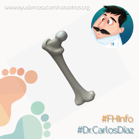 FHayudaacamina's tweet photo. Muchos niños con FH, tienen un crecimiento lento del fémur, esto conduce a una diferencia en la longitud del miembro #FHInfo #Dr.CarlosDíaz https://t.co/QP5HU3JnFW