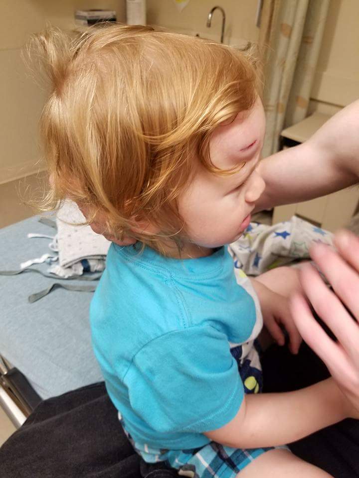 razorbacks6sic6's tweet photo. He tripped and smashed his head on the door frame. Gotta watch him close for the next 4 hours. 😢 https://t.co/W98VRHVDTJ