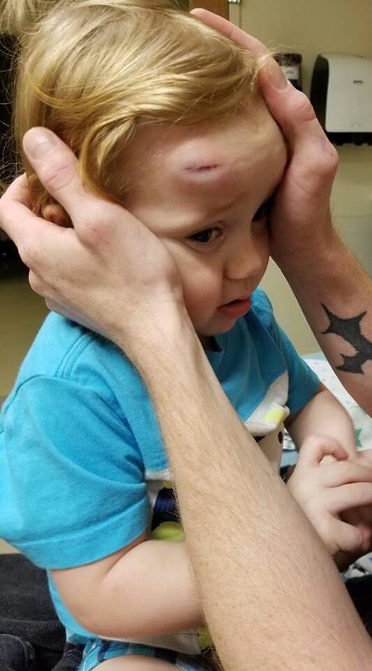 razorbacks6sic6's tweet photo. He tripped and smashed his head on the door frame. Gotta watch him close for the next 4 hours. 😢 https://t.co/W98VRHVDTJ
