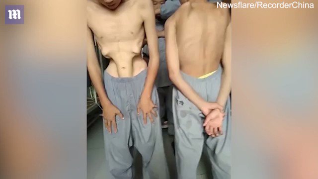 KokoRiko2014's tweet photo. @TheWorldOfFunny These Boys Have Pretty Epic Talents
             *****************
Click here: https://t.co/TPuVNHDSfy https://t.co/KtAtIAa0r3