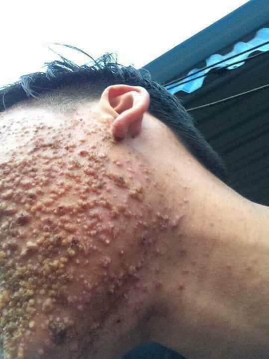 jairoorta's tweet image. Rt inmediato o mañana despertas así 😷