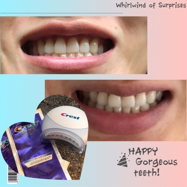 Crest Whitestrips with Light Review Easy to use whitening product for teeth