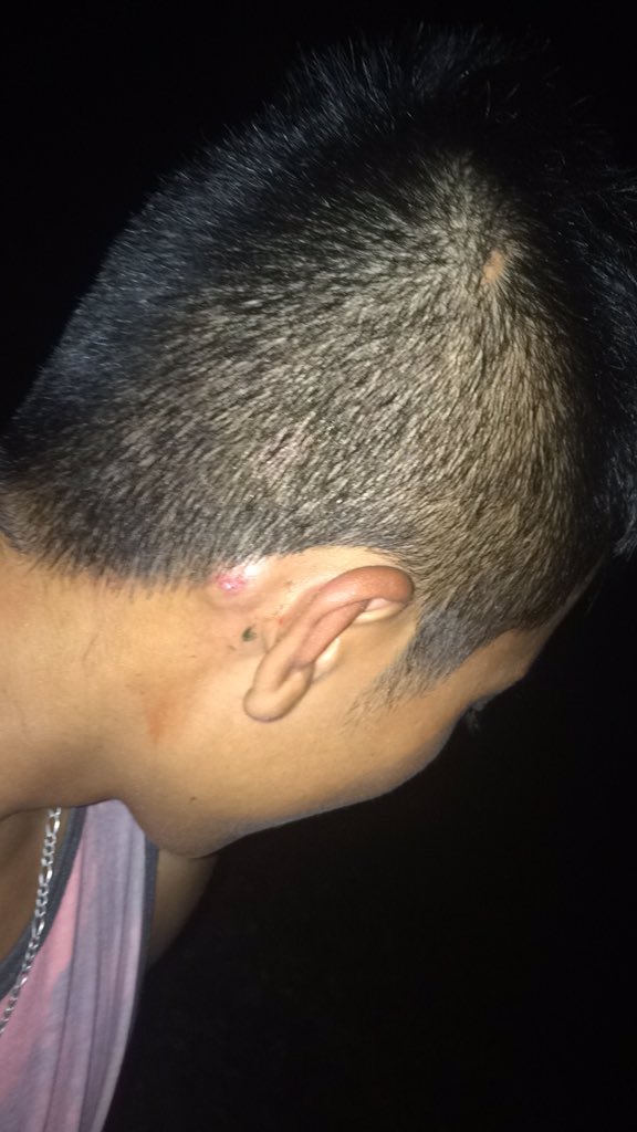 Nathan_Mccall15's tweet photo. @kelsomc9 @jamccall12 It's okay, I got hit with one too! 😂 https://t.co/RjysZCpfg7
