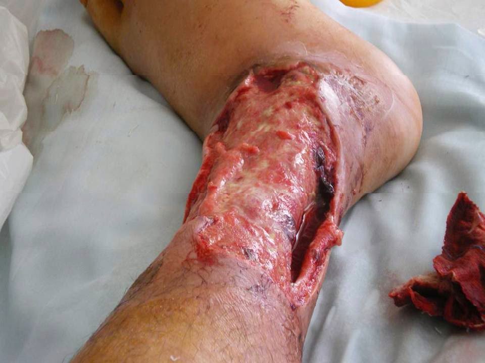 RT🔄🔁 em 3 segundos ow sua perna ficará assim '-'