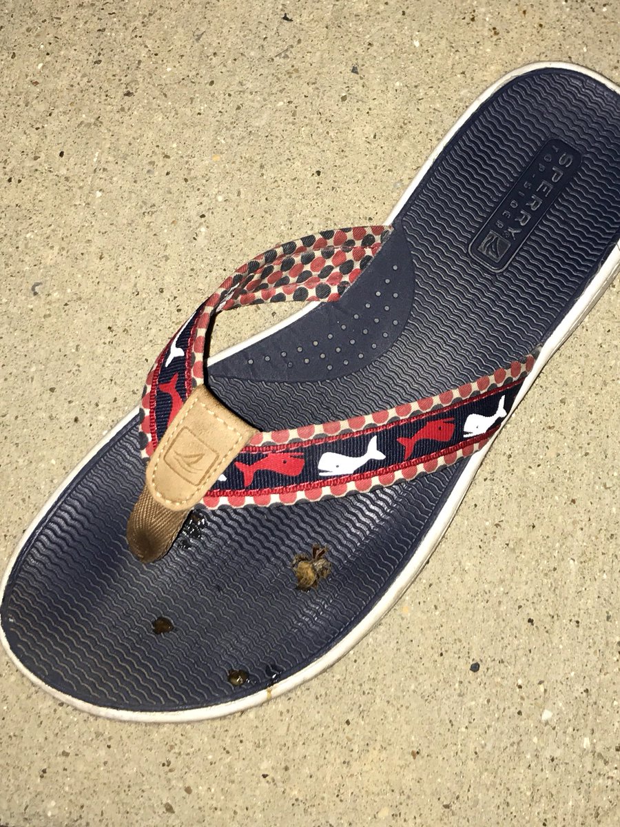 alliegator1111's tweet photo. Tried to stomp on a spider that was on my car and it ended up UNDER MY TOES IN MY FLIP FLOPS 🙃🙃🙃 https://t.co/H5Gu7L6u3A
