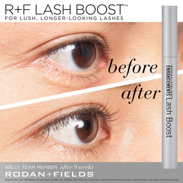 ssather1213's tweet photo. Join me to learn about Rodan + Fields® and how we're changing skin and changing lives. https://t.co/VqJBexXNHl