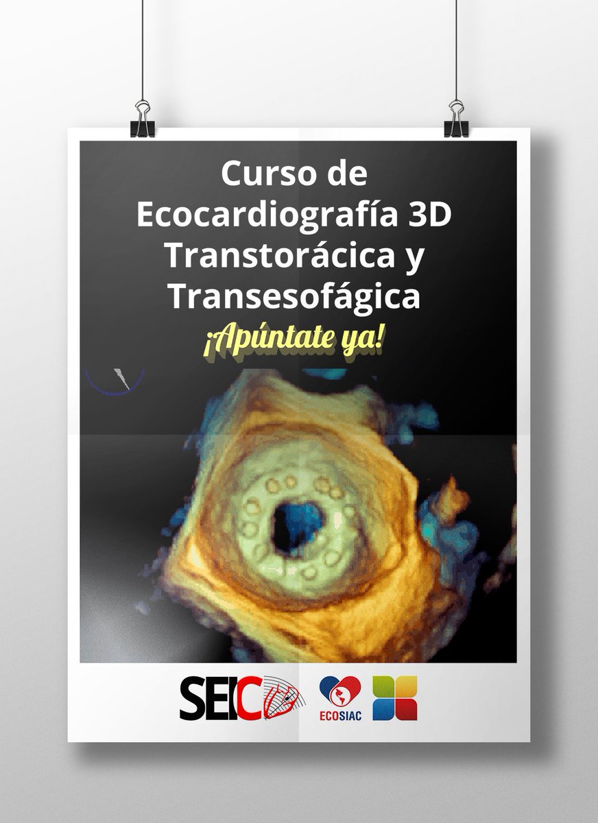 ImagenCardiaca's tweet photo. Aprender Eco 3D ETE/ETT está a tu alcance con este nuevo curso online de #SEIC y ECOSIAC
¡Últimos días de matrícula!
https://t.co/qwH111fOZa https://t.co/uUghOQLdH2