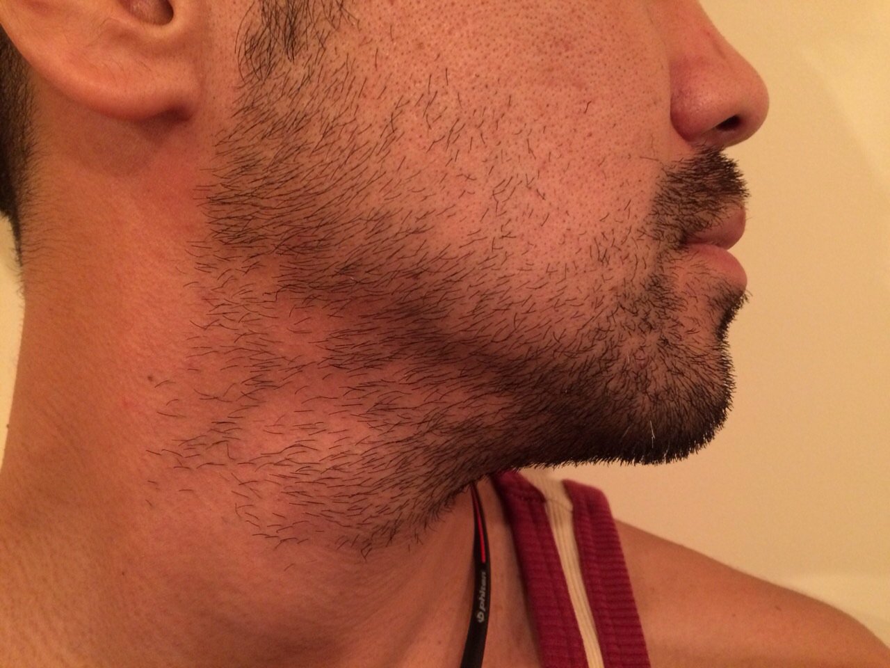 メンズ脱毛サロンyes関西 En Twitter ヒゲ脱毛でどれだけヒゲが無くなるか想像できますか Yesのヒゲ脱毛でこれだけ変わる メンズ脱毛サロン Yes T Co Tr9kydsvk2 脱毛前後 T Co Yaloy5dncx メンズ脱毛 青髭解消 泥棒ヒゲ T Co