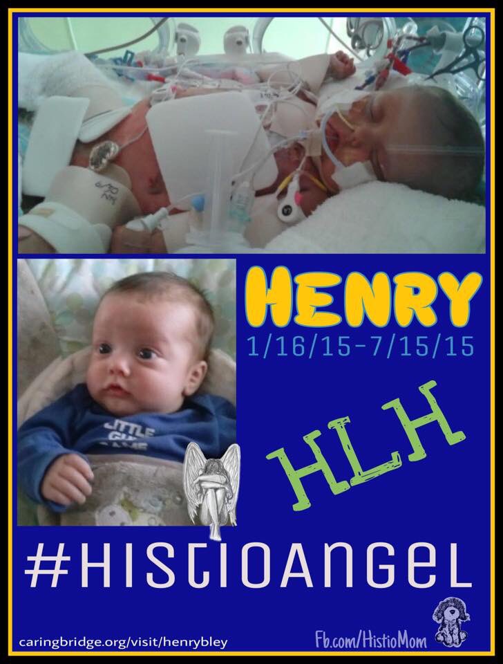 histio_mom's tweet photo. #HistioAngel Henry had a terrible battle with #HLH.
Read his story so you can #BeHistioAware
https://t.co/FK1O3c18ov
https://t.co/MZJA8I4Jk0 https://t.co/rsHnXfnMNV
