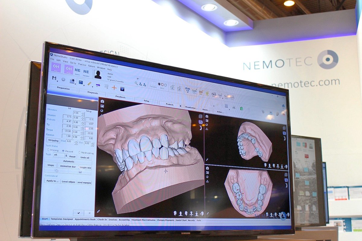 nemotec's tweet photo. Trabaja con modelos digitales gracias a #NemoCast de @nemotec 

#nemostudio #ortodonciadigital #FDI #fdi2017 #dentistry #3dmodels https://t.co/8gCxsNzXQ8