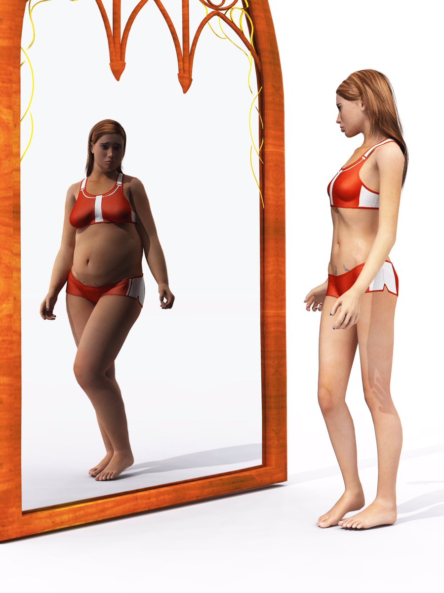 DrAshishDutta's tweet photo. #BodyDysmorphicDisorder affects 2% of people, and of this figure, around 15% of them visit #CosmeticSurgeons.
https://t.co/nfCLPDrQT0 https://t.co/Ij6IxRmNwP