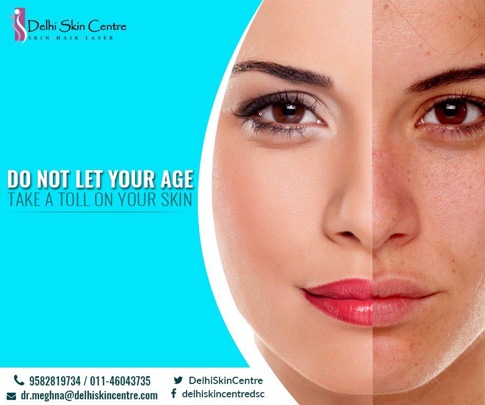 DelhiSkinCentre's tweet photo. Radiant peels are a great way to rejuvenate your skin and give it a boost. #DelhiSkinCentre #advancedskincare #dermpath #skincareservice https://t.co/Ufe9QFarVn