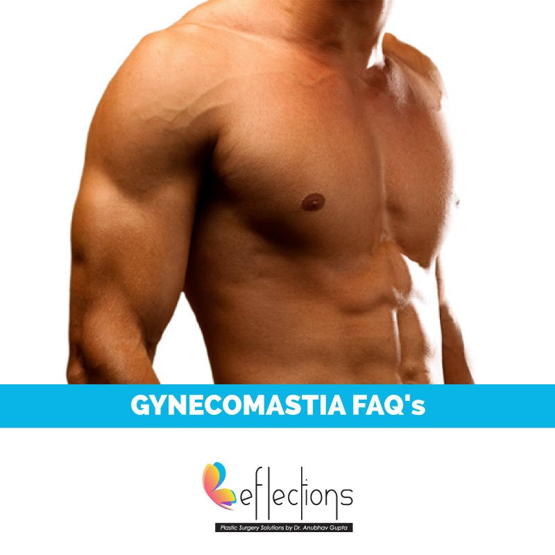 ClinicReflect's tweet photo. #FAQ: When #Gynecomastia procedure is recommended?
Ans: When unwanted fat can’t be removed due to weight loss exercise alone  #Reflections https://t.co/XxjqYevYpV