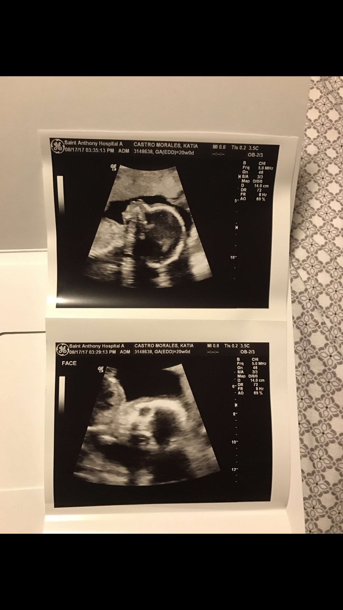 BasedGodGio's tweet photo. This has got to the one of the happiest days of my life. Seeing our little one grow. Mom and dad love you 💞 https://t.co/wXwqhxU77P
