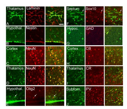 pknoepfler's tweet photo. Stem cell transplants: hIPSC and hESC behave similarly in brain &amp; often fuse with host cells https://t.co/pS1XkZC3nU https://t.co/cUbfNIfLH6