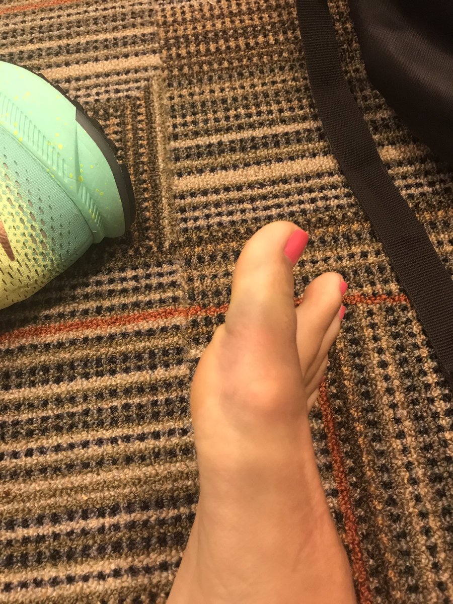 NickiCollen's tweet photo. Yup sometimes even coaches need the cold tub!!! #badlystubbedtoe #triedtoguardAlyssaThomas #shouldnthave https://t.co/uoVHT0jHGB