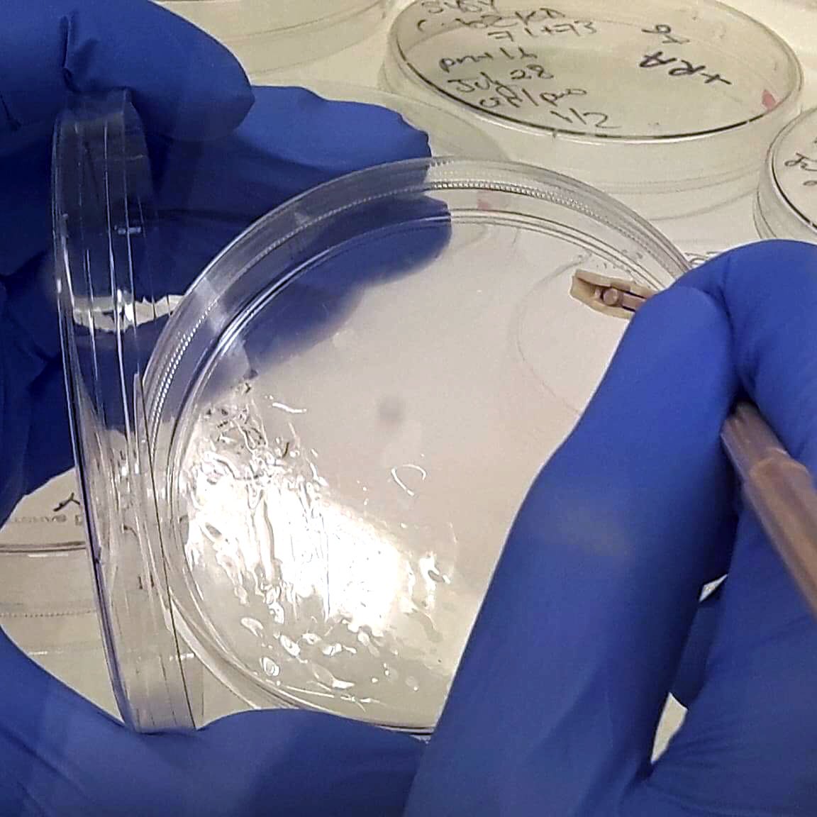 KingstonRIOT's tweet photo. Harvesting cells! #TissueCultureCrashCourse #TCCC https://t.co/zkvq0nPwDj