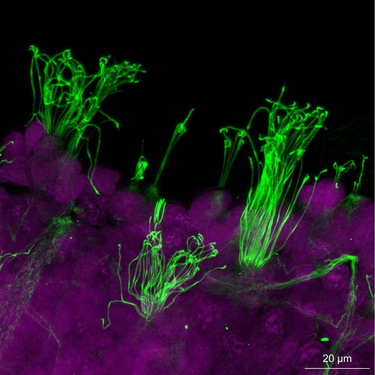 m_scheibinger's tweet photo. @MBLScience @zeiss_micro @EarBiology
Squidlet https://t.co/9pOdcS5brJ