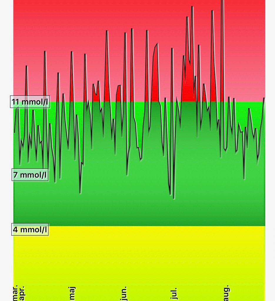DocsDiabetes's tweet image. Working on a new feature this Month - hope to launch soon - it is doing magic to my BG 😄#type1 #diabetic