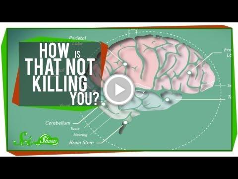 How Is That Not Killing You? vid.staged.com/M34u #mold #allergies #moldornot