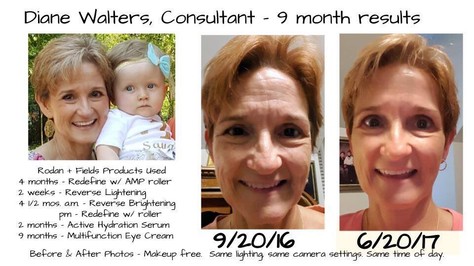 Amazing! My skin has never felt better ❤️
Dwolff21.myrandf.com