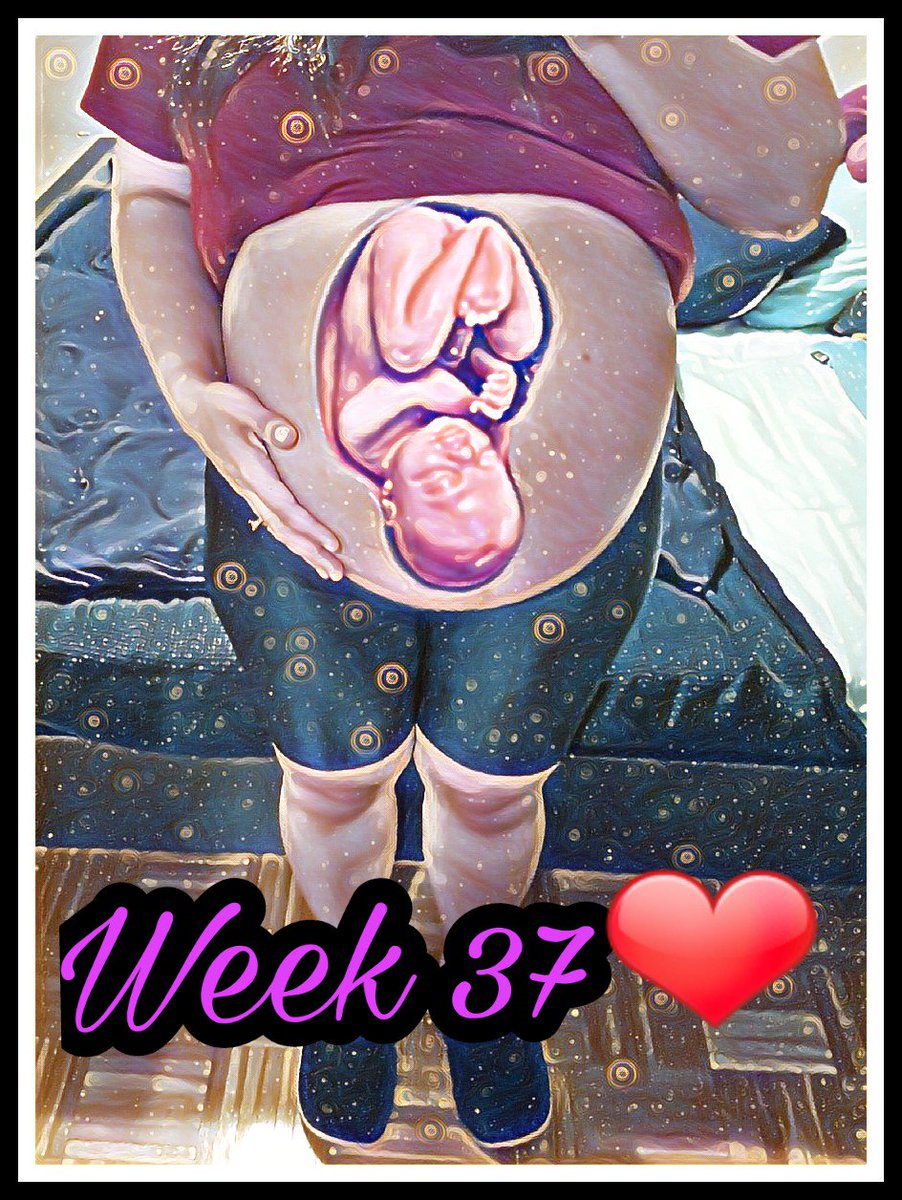 LynetteRodrigo's tweet photo. @BabyBumpApp #week37 #almostder #pregnancybelly #everyoneisexcited https://t.co/VuOD0ekyvi