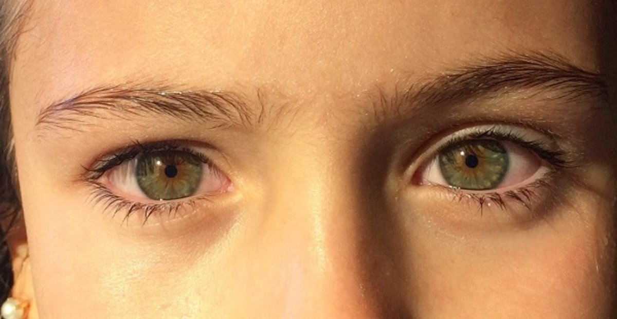 OpticaliaCVG's tweet photo. Protegeix els teus #ulls a l'estiu https://t.co/sb8XfVF1e3 Via @addthis https://t.co/s6VsVyrIFX