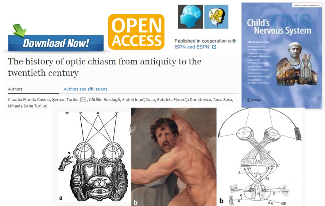 ClinMedJournals's tweet photo. #CNS
#OpenAccess https://t.co/tKxUfAdgCp
Discover the #OpticChiasm: a fascinating time travel through #Anatomy and #HistoryofMedicine https://t.co/lmEtj5INEg