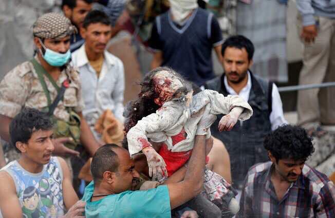 Mo_Alghaithi's tweet photo. Today #Saudi &amp;  #Emirates with #US_support targeting civilian houses in #Sanaa and kill 14 people, including 6 children and two women #Yemen https://t.co/pvguVXbpHg