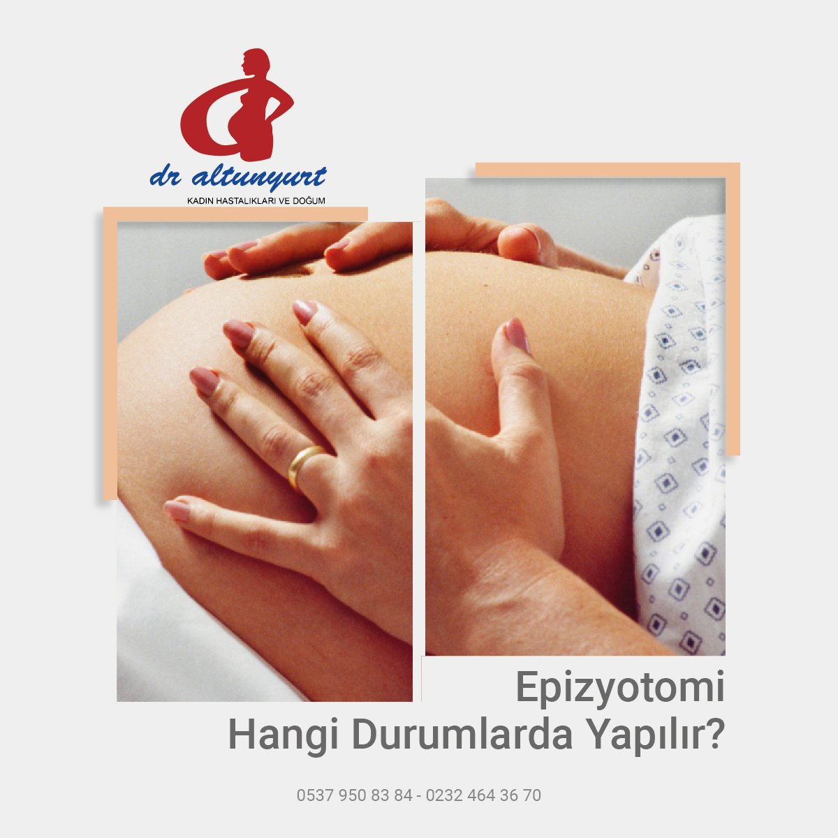 profdraltunyurt's tweet photo. Epizyotomi Hangi Durumlarda Yapılır?

https://t.co/dOHrPvuh4x https://t.co/5Ljp7UYibD