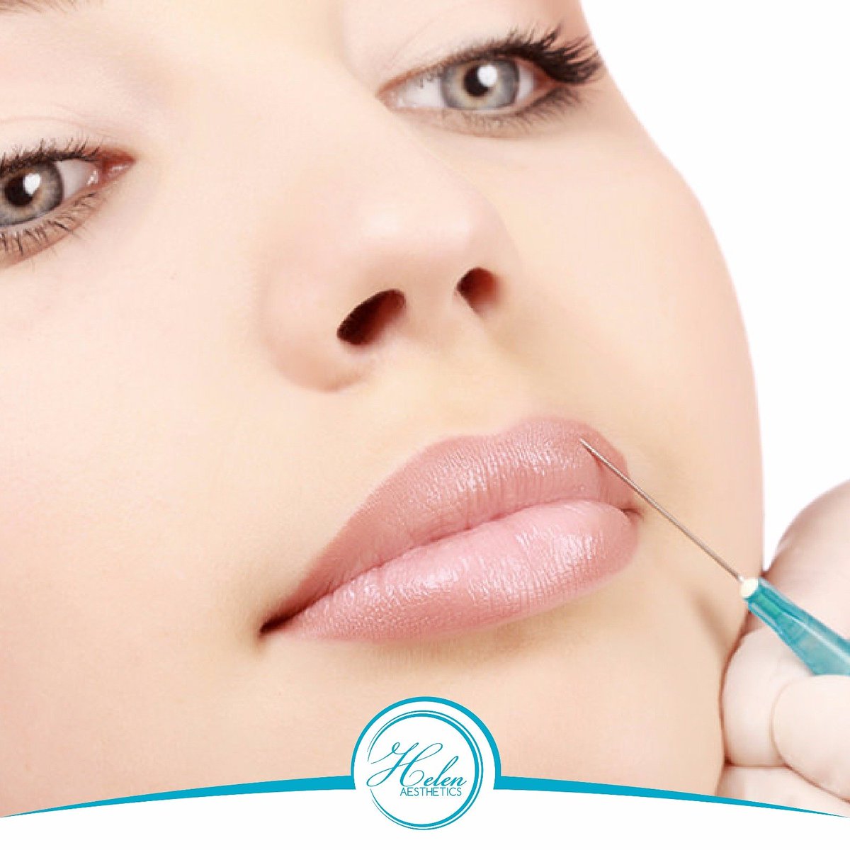 Dudakların köşeleri ile orantılı şekilde yapılacak dolgu; doğru ve yüz güldüren sonuçlar verilmesini sağlayacaktır #dudakdolgusu #botoks