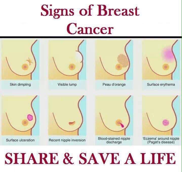 No reason not to share this, prevention is better than cure. #remake