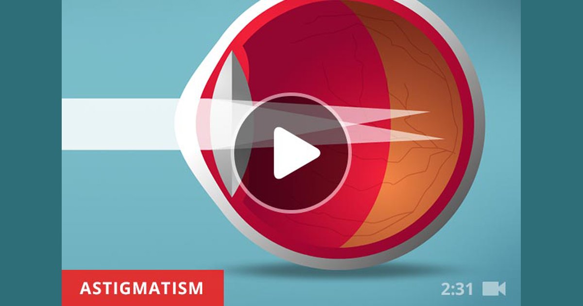 AllAboutVision's tweet photo. This is what #astigmatism looks like. #EyeCare #EyeHealth https://t.co/gQghlnAbqo https://t.co/AYPFA7yNP0