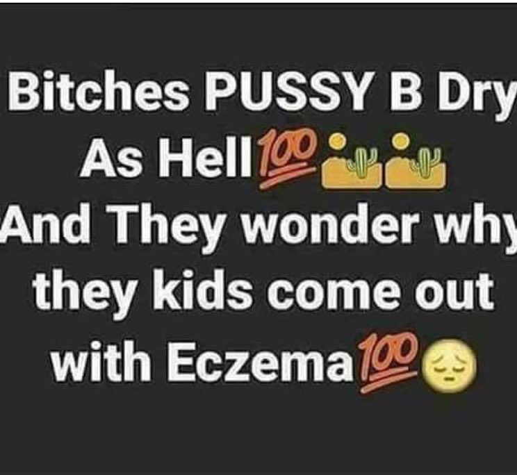 😭😭😭😭💀
