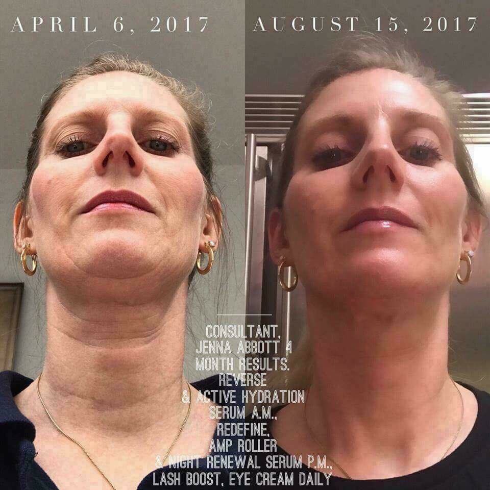 absltIyflawlash's tweet photo. Get rid of that ๐ฆ #turkeyneck before #Thanksgiving !!! #byewrinkles #byewaddle #rodanandfields #ampmdroller https://t.co/vVmJ5x9Kp5 https://t.co/G1ePp4hqFz