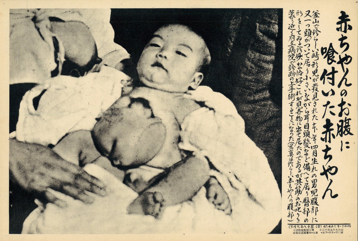 書肆ゲンシシャ 幻視者の集い エロ グロ ナンセンスの時期の報道写真 いずれも昭和11年に発表された報道写真です 阿部定事件から 性転換 奇形児の出産 やはり女だ という見出しなど当時の状況がわかる内容になっています 同年には二 二
