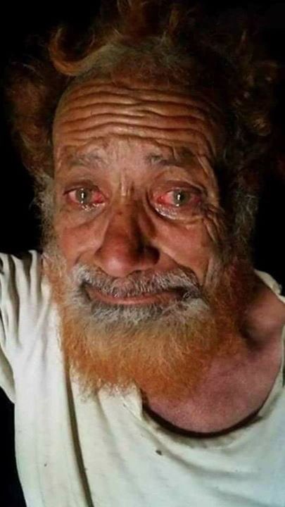 Halitisci's tweet photo. Suud bombalarından çocuğunu korumaya çalışırken can veren bir anne ve gözleri ağlamaktan kan çanağına dönmüş bir Yemenli.
#Yemen https://t.co/FezvG4cVsW