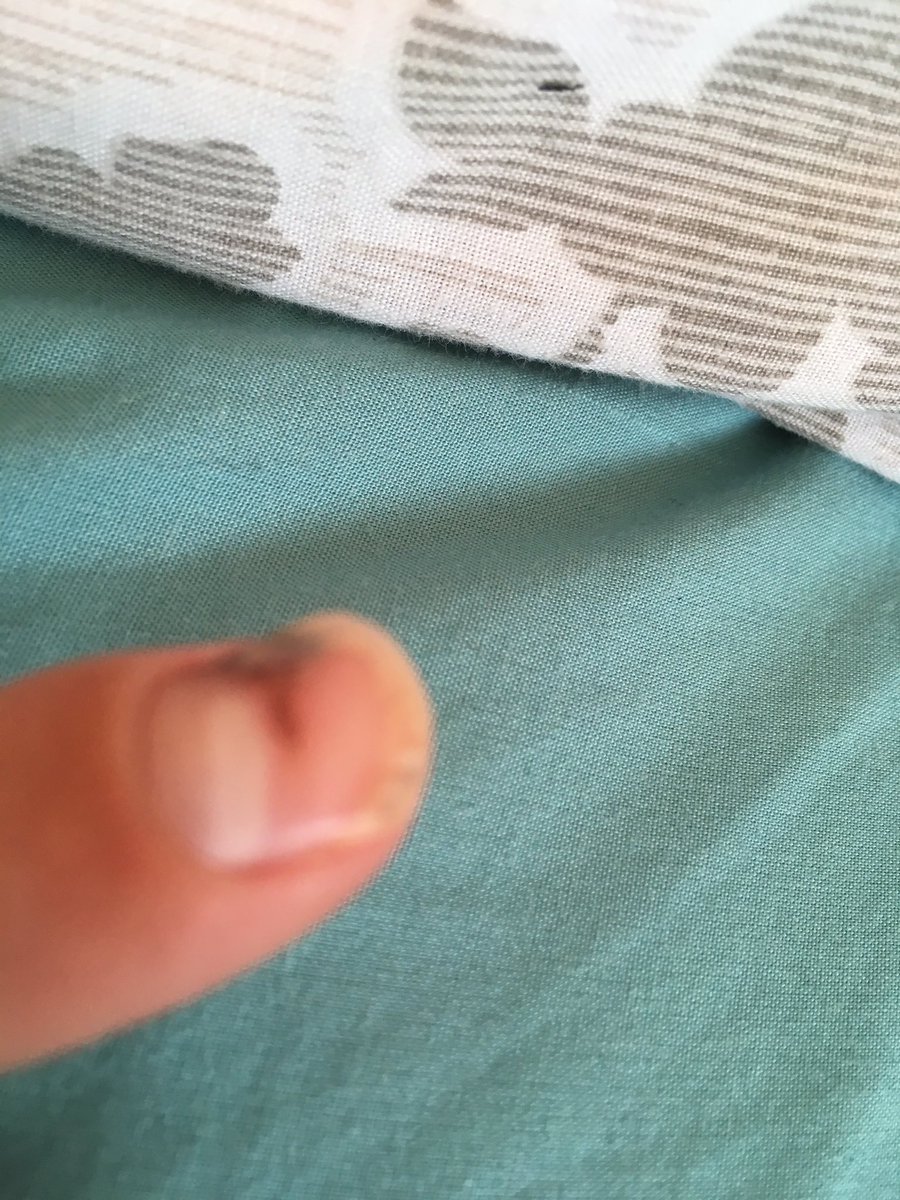 sirius755's tweet photo. @nailogical my so called friend trapped my finger in a door https://t.co/AhStgOcp0k
