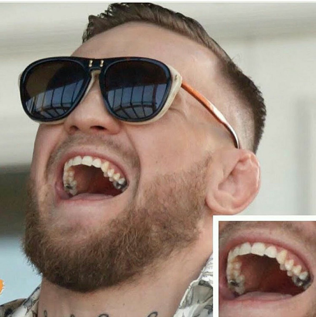 Dentagama's tweet photo. When you are a millionaire but still stuck with those amalgam fillings https://t.co/Ii82bFOPBA