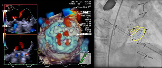 Siemens Healthineers tweet media