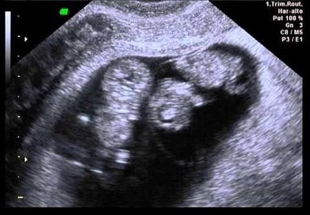 <a href="/TuRubio26/">batprince. 🔥</a> tomar una captura*