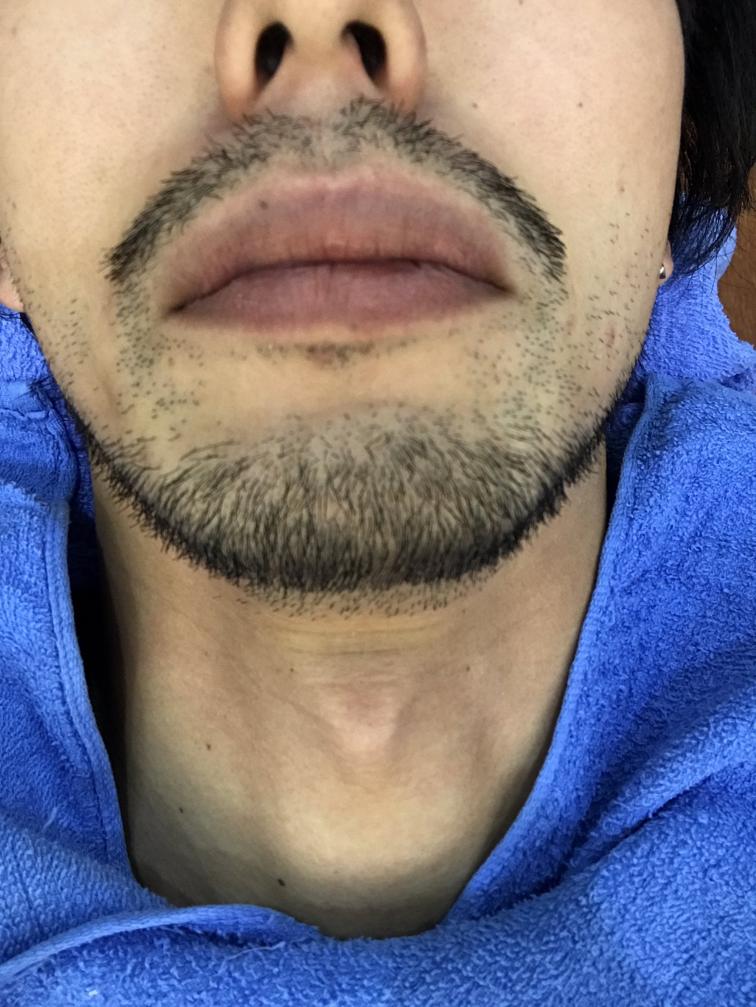 桜井宏彰 Sky 今野くんがヒゲ整えてくれました Hairsalonsky ヒゲデザイン T Co Ixemgkdi2p Twitter