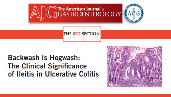 AmCollegeGastro's tweet image. #AmJGastro Red Section: Backwash Is Hogwash: The Clinical Significance of #Ileitis in #UlcerativeColitis rdcu.be/viHP