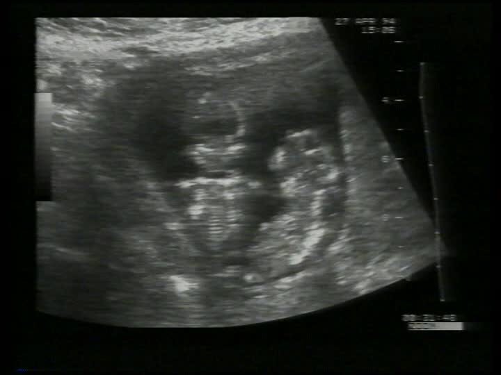 <a href="/TuRubio26/">batprince. 🔥</a> creciendo en su justa medida… hasta ahora no hay nada de qué preocuparse