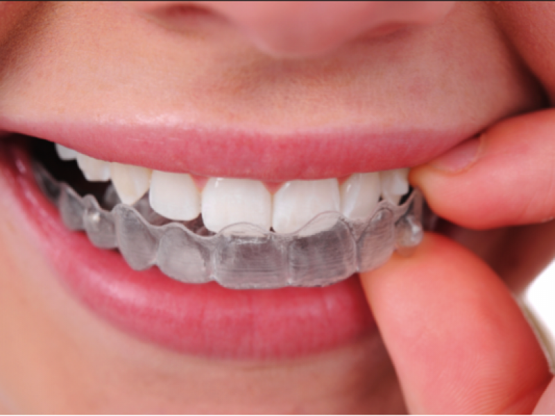 Yaravi231's tweet photo. #Ideas2017BMI Aparatos dentales elaborados a partir de los derivados obtenidos de la quitina para mejorar la salud e higiene dental. https://t.co/goxBZngc2N