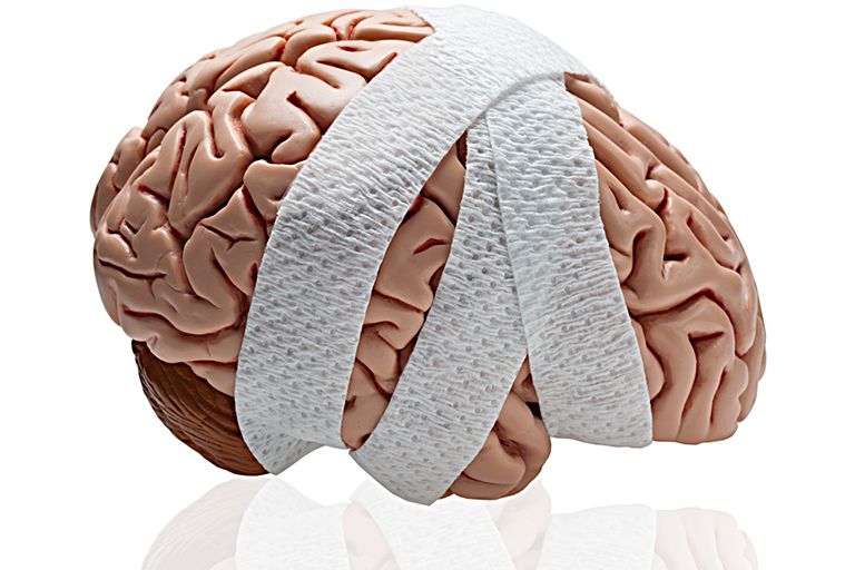 scriptmedic's tweet image. "BS Medical Tropes That Need to Die TODAY, Part 2: 'Safely' Rendering People Unconscious" #posts #writingreference buff.ly/2wnSOpF