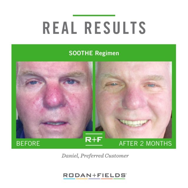 Join me to learn about Rodan + Fields® and how we're changing skin and changing lives.