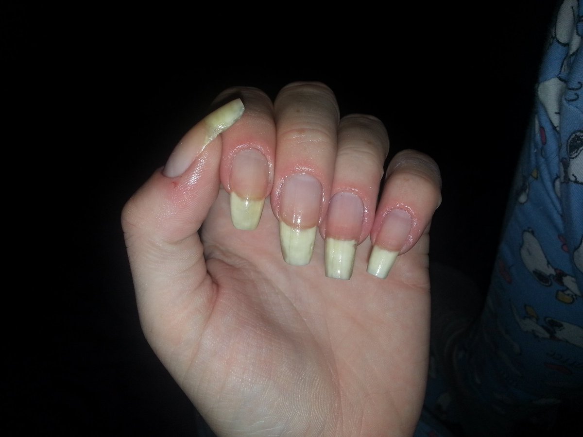 simsterrxx's tweet photo. I was a nail bitter from when I grew teeth up until 3 years ago. This strength has taken me 3 years to gain and I love them 😊 @nailogical https://t.co/zriXHTVQS7