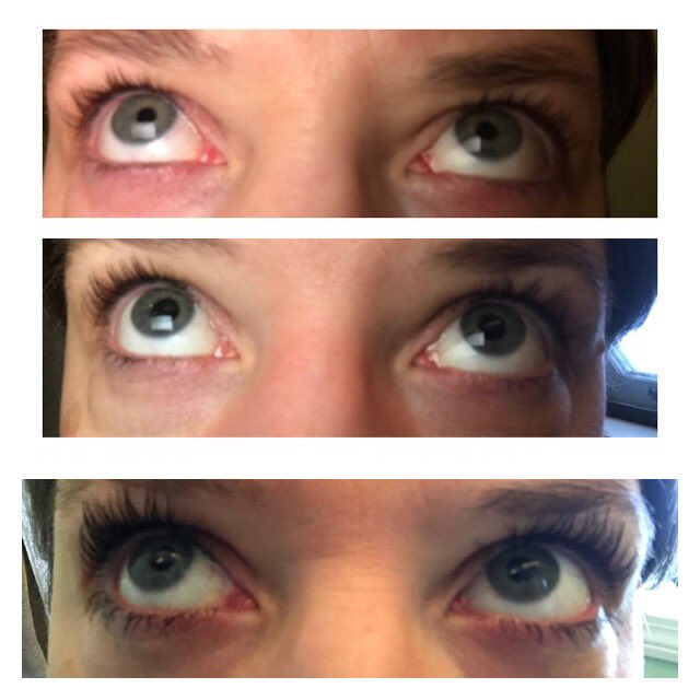 Great skin and great lashes. These are my own lash boost results. See why it's my favorite?  #randf #youonlygetoneface #savemoney #lashboost